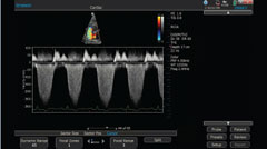 cardiology-tab-1