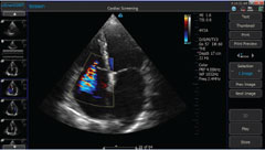 critical-care-tab-1