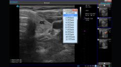 clinical-app-breast-why-terason-tab-photo