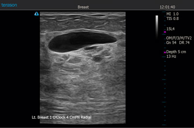 Smart Resolution Imaging