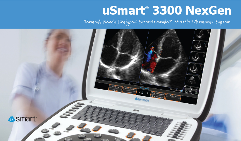 uSmart 3300